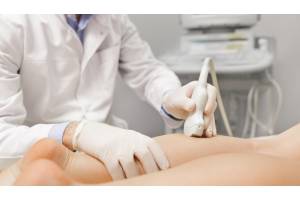 Por qué Varicenter es referencia en el tratamiento de varices en Alicante